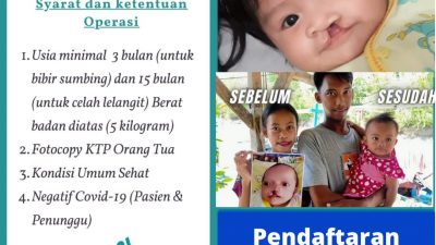 Kabar Gembira, RSUD Muhammad Zyn Sampang Melayani Operasi Bibir Sumbing Secara Gratis